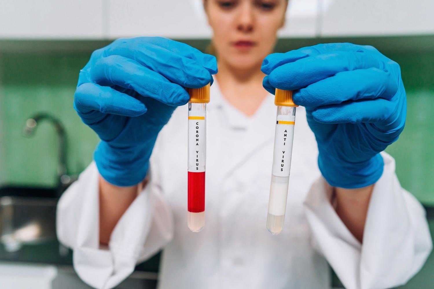 Tube Test Diagnosis in Gurgaon